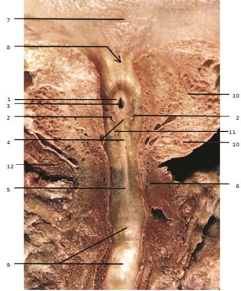  Фронтальный анатомический срез предстательной железы на уровне мочеиспускательного канала