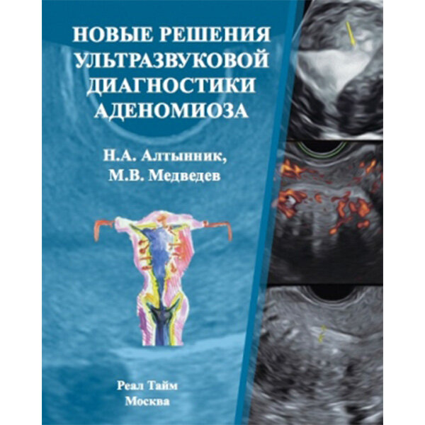 Купить книгу "Новые решения ультразвуковой диагностики аденомиоза" - Н. А. Алтынник, М. В. Медведев в интернет-магазине медицинской книги shopdon.ru Купить книгу "Новые решения ультразвуковой диагностики аденомиоза" - Н. А. Алтынник, М. В. Медведев в интернет-магазине медицинской книги shopdon.ru