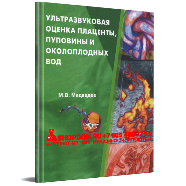 Купить книгу "Ультразвуковая оценка плаценты, пуповины и околоплодных вод" - М. В. Медведев в интернет-магазине медицинской книги shopdon.ru Купить книгу "Ультразвуковая оценка плаценты, пуповины и околоплодных вод" - М. В. Медведев в интернет-магазине медицинской книги shopdon.ru