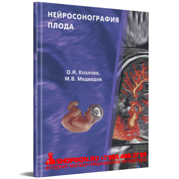 Купить книгу "Нейросонография плода" - М. В. Медведев, О. И. Козлова" - Н. А. Алтынник, М. В. Медведев в интернет-магазине медицинской книги shopdon.ru Купить книгу "Нейросонография плода" - М. В. Медведев, О. И. Козлова" - Н. А. Алтынник, М. В. Медведев в интернет-магазине медицинской книги shopdon.ru