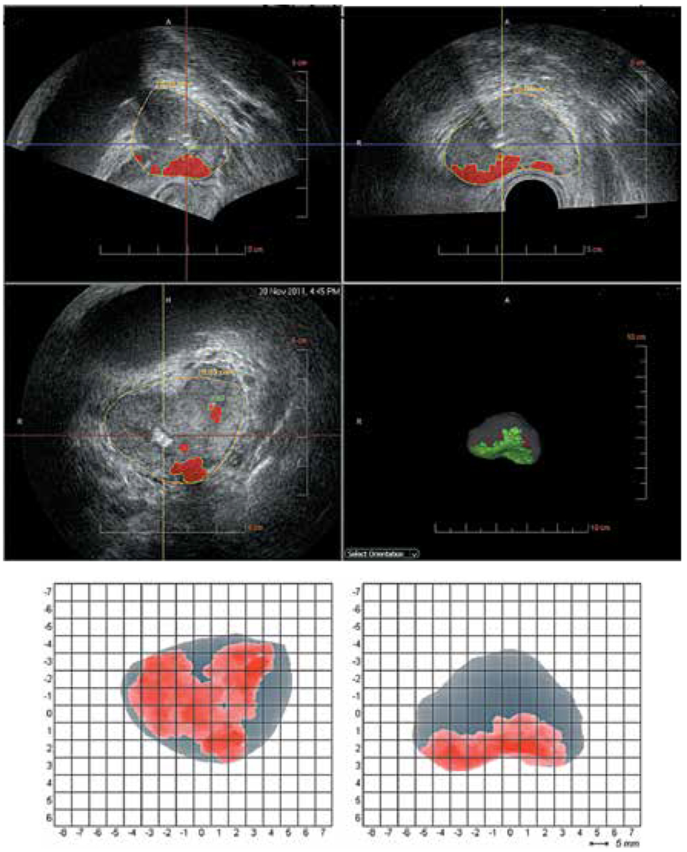 Рис. 12. Пример изображений, получаемых с помощью HistoScanning