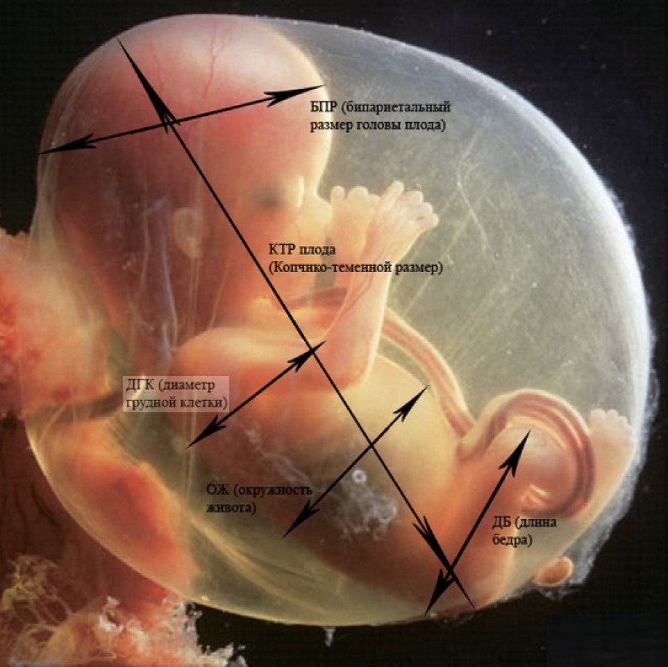Бпр на узи при беременности. Фетометрия БПР при беременности. Бипариетальный размер головки плода. УЗИ БПР плода что это. Что такое бипариетальный размер плода на УЗИ.