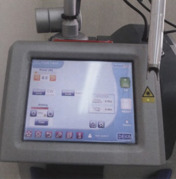 Хирургический лазер