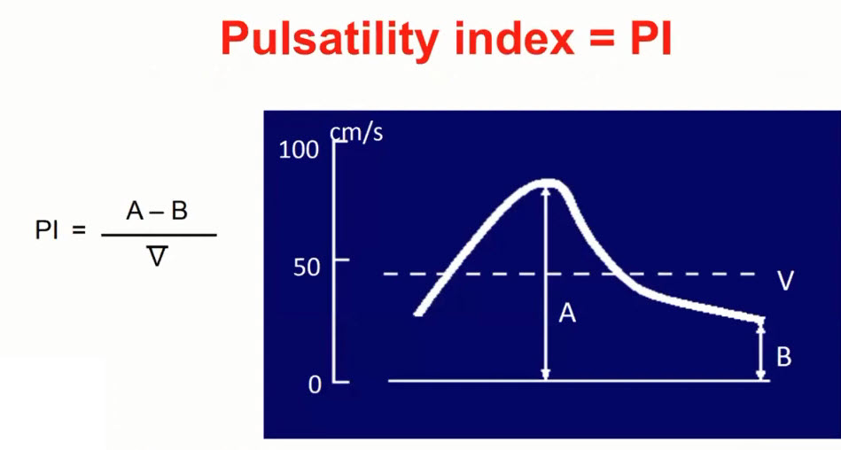 Pulsatility index = PI