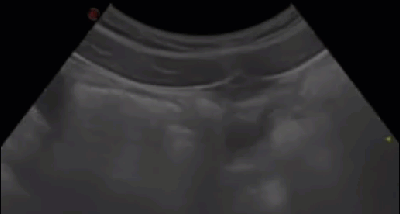 Предположительно беременность раннего срока