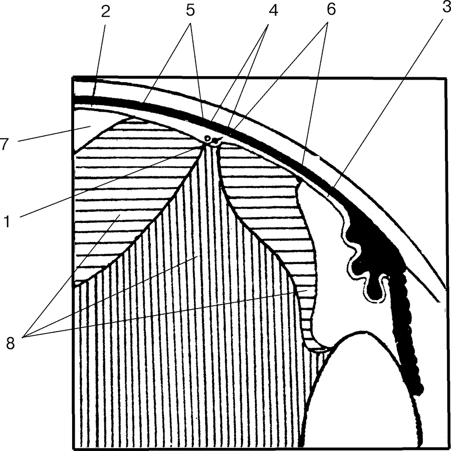Рис. 26. Схема топографии переднего основания стекловидного тела (по: Eisner G., 1973