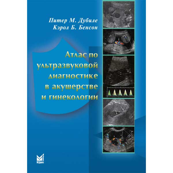 Купить книгу "Атлас по ультразвуковой диагностике в акушерстве и гинекологии" - Питер М. Дубиле, Кэрол Б. Бенсон