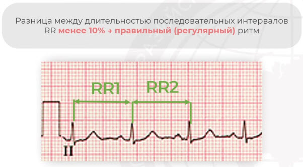 Оценка регулярности сердечных сокращений