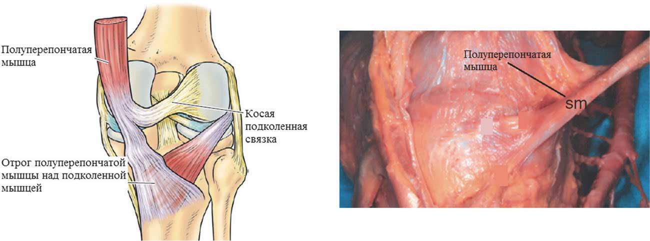 Схематическое изображение и анатомический препарат заднемедиальной поверхности колена