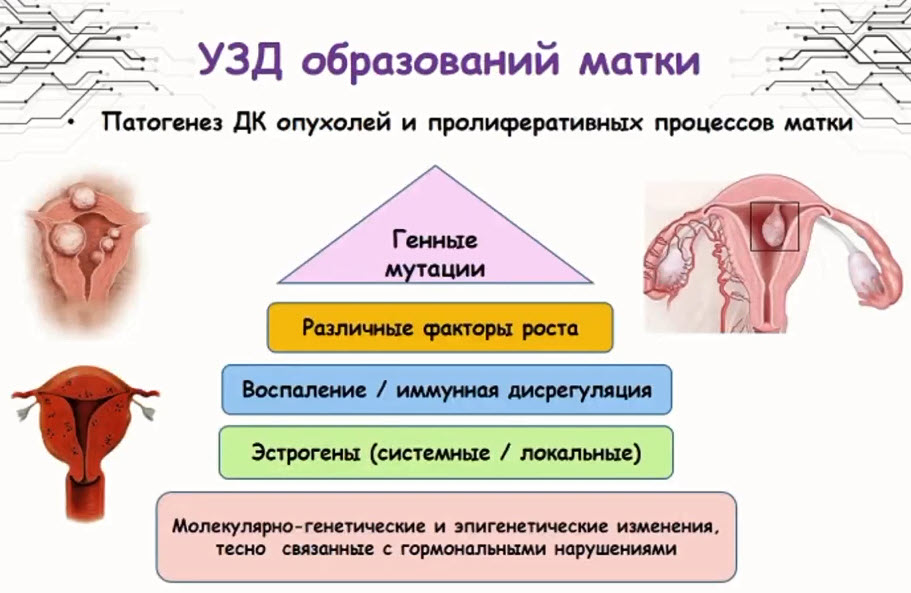 УЗД образований матки. Патогенез ДК опухолей и пролиферативных процессов