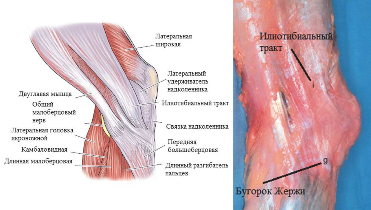  Схематическое изображение и анатомический препарат латеральной поверхности колена
