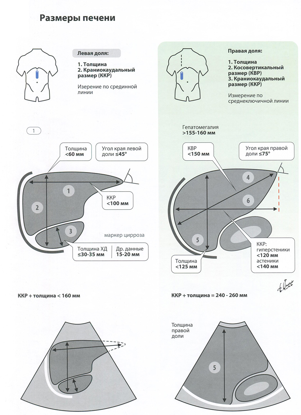 УЗИ диагностика. Размеры печени