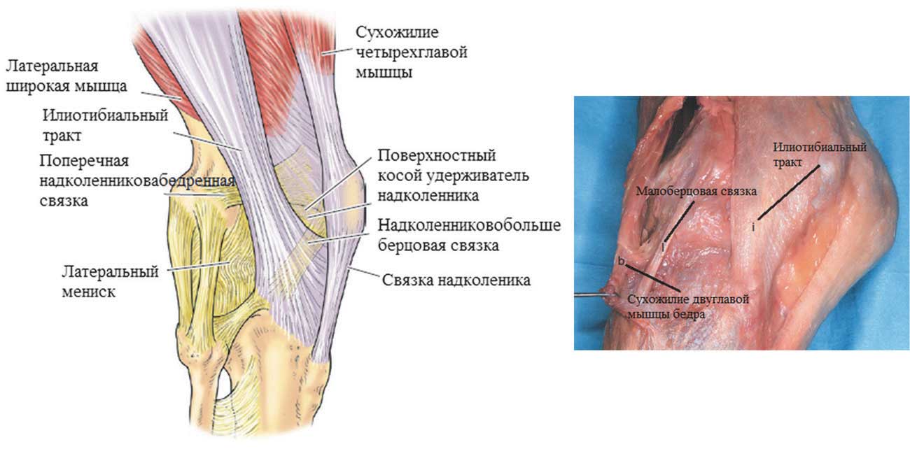 Схематическое изображение и анатомический препарат латеральной поверхности колена