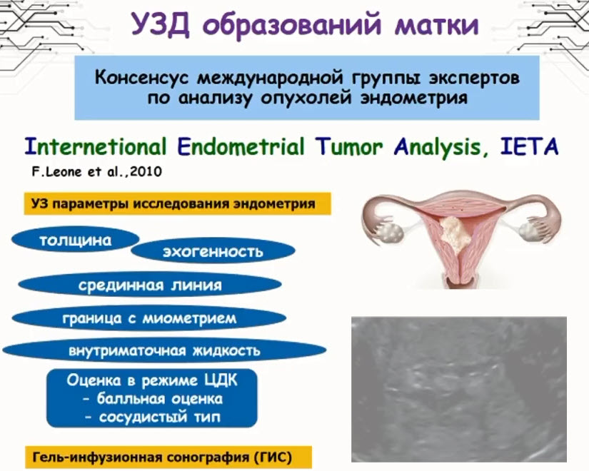 Консенсус международной группы экспертов по анализу опухолей эндометрия.
