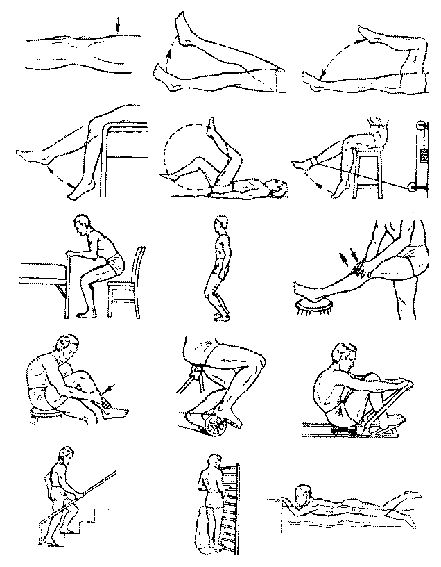 Примерный комплекс физических упражнений для восстановления функции коленного сустава