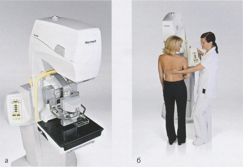  Рентгеномаммография: а — аппарат для рентгеномаммографии; б — врач выполняет исследование
