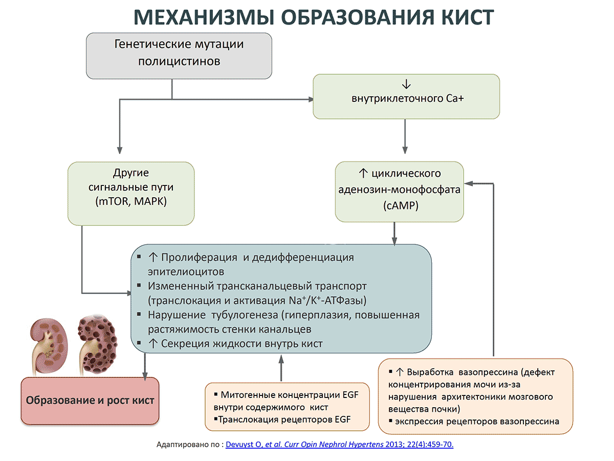 Механизмы образования кист