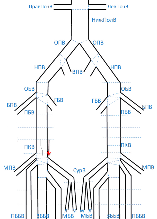 Линейный датчик ПКВ - практически невидимые в В-режиме тяжистые структуры