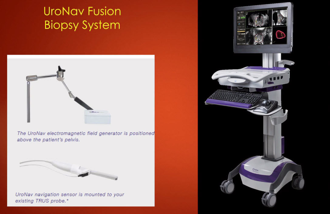 UroNav Fusion Biopsy System