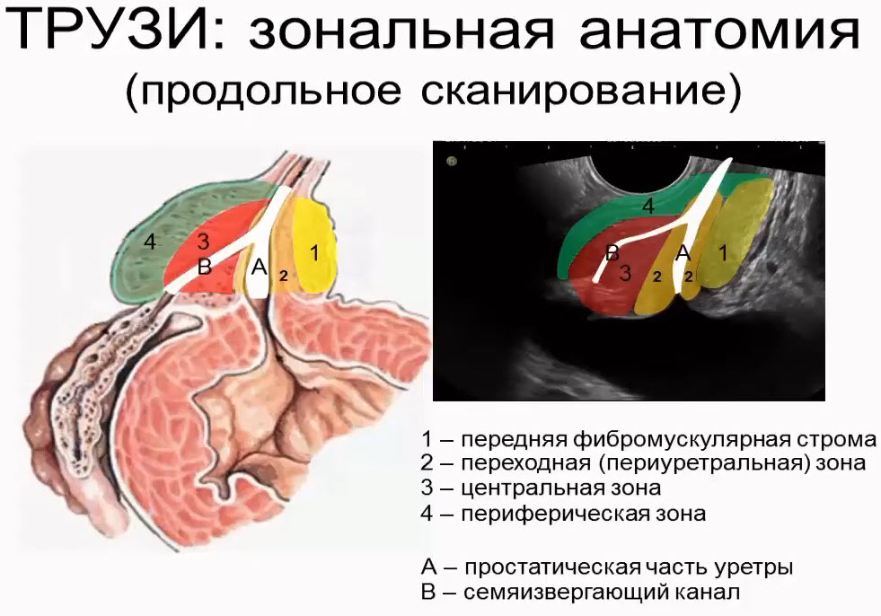 ТРУЗИ: зональная анатомия (продольное сканирование)