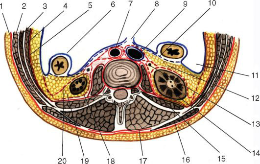 Рис. 9.4. Фасции и клетчатка поясничной области на горизонтальном срезе (красный пунктир - забрюшинная фасция, fascia extraperitoneal)