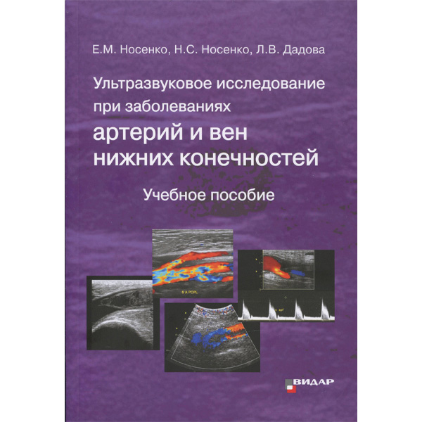 Купить книгу "Ультразвуковое исследование при заболеваниях артерий и вен нижних конечностей" - Носенко Е. М. в интернет-магазине медицинской литературы shopdon.ru