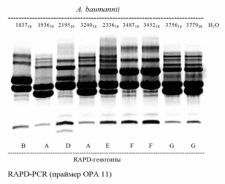 При типировании Л. baumannii (номер образца 3756 и 3779) методом RAPD-PCR