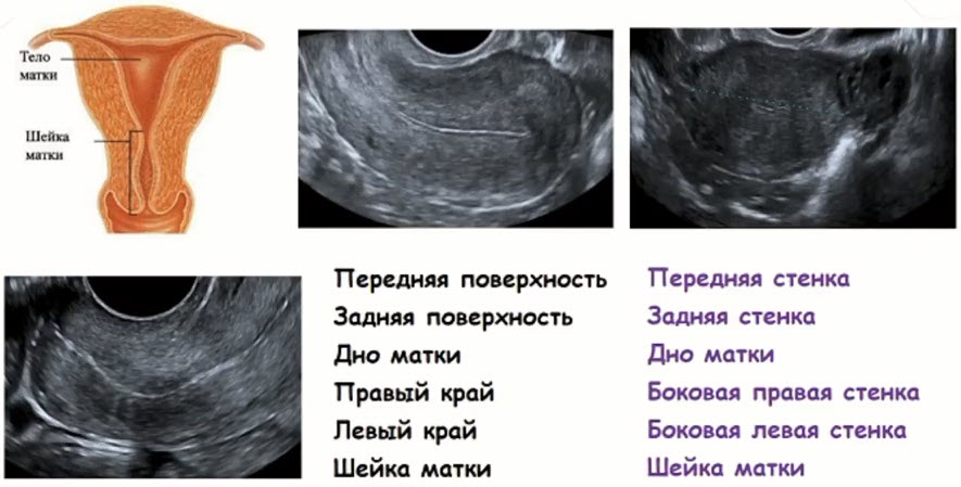 Ультразвуковая анатомия и биометрия матки