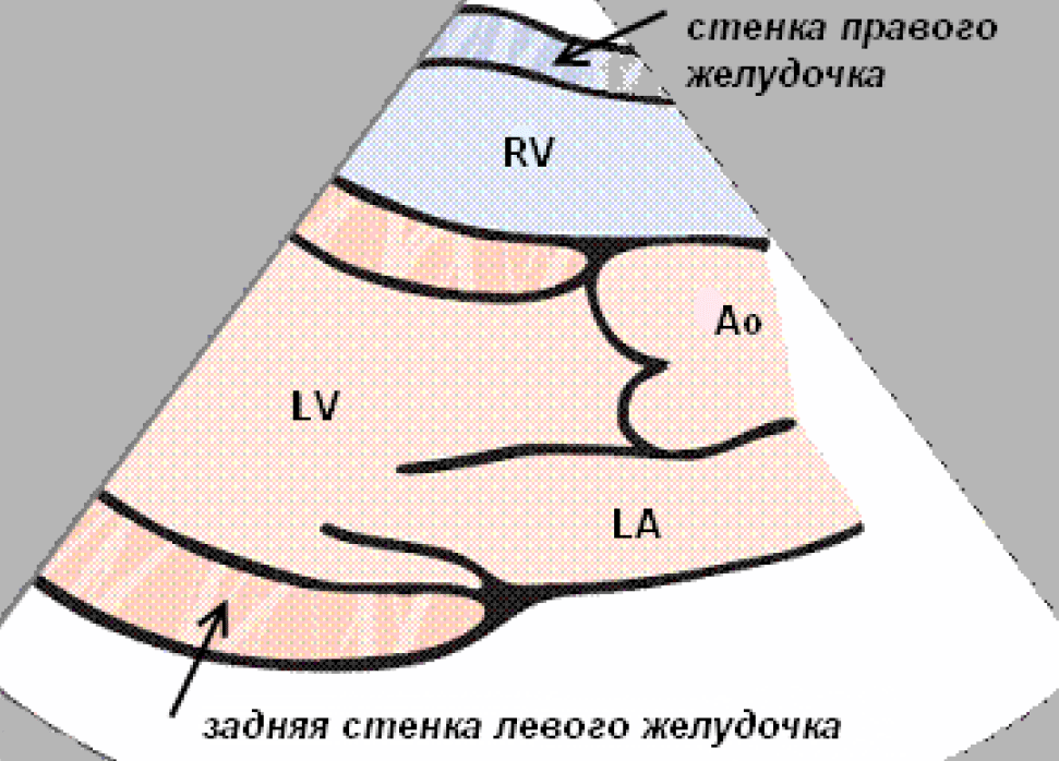 В этой позиции видны правый и левый желудочек, митральный клапан, аорта и левое предсердие