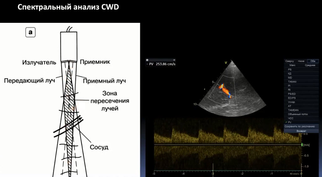 Спектральный анализ CWD