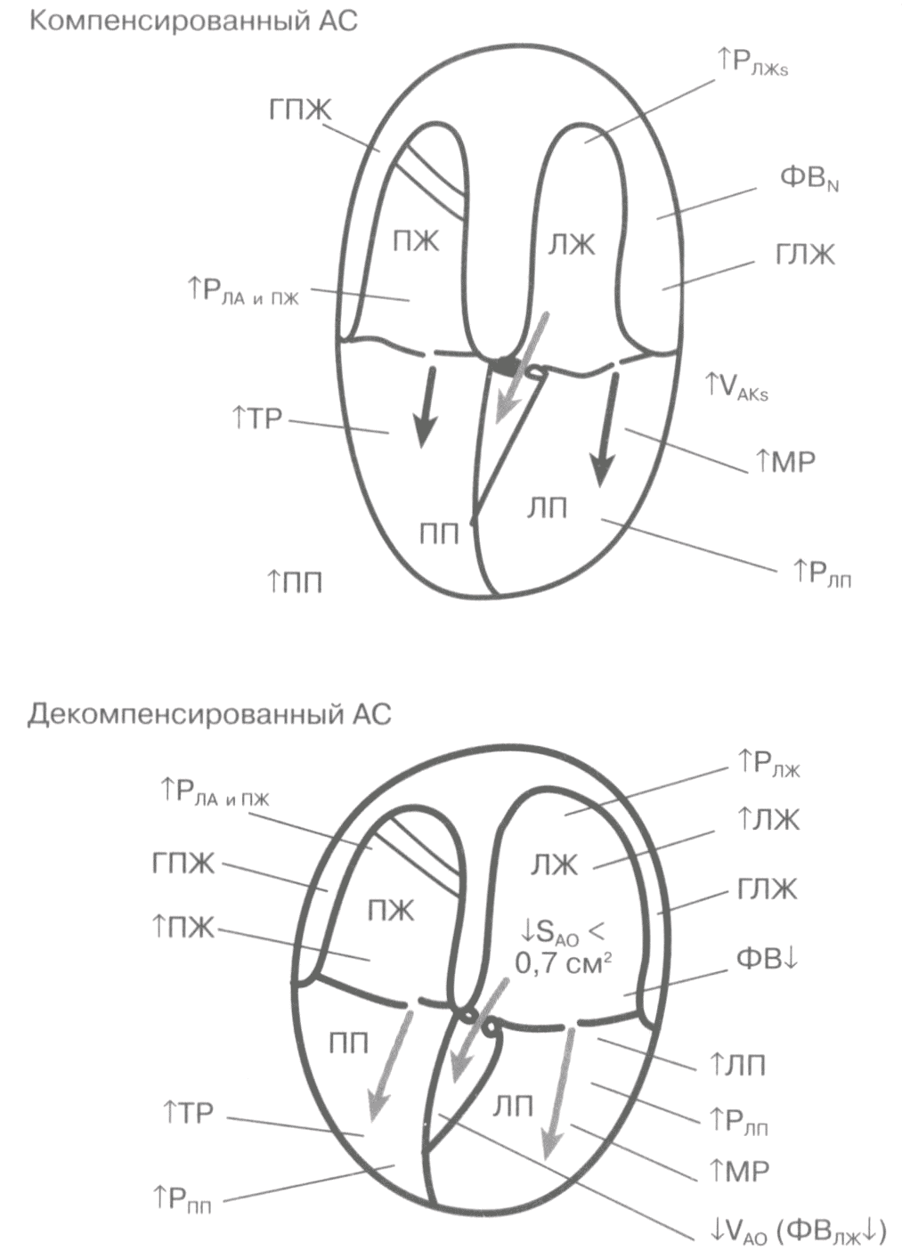 Гемодинамическая оценка степени аортального стеноза