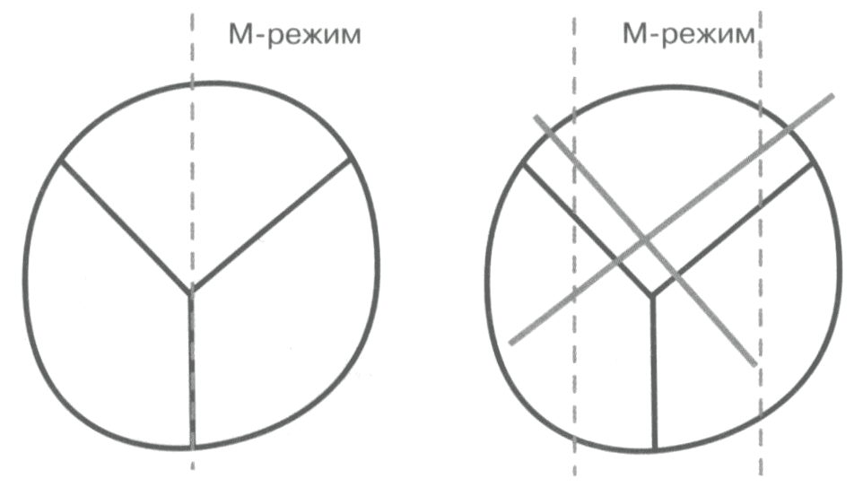 Технология проведения исследования В- и М-режимы