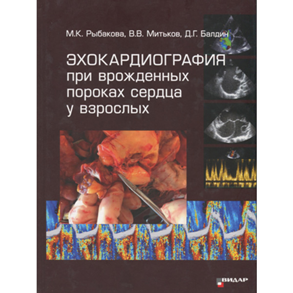 Купить книгу "Эхокардиография при врожденных пороках сердца у взрослых" - М. К. Рыбакова, В. В. Митьков, Д. Г. Балдин в интернет-магазине медицинской книги shopdon.ru Купить книгу "Эхокардиография при врожденных пороках сердца у взрослых" - М. К. Рыбакова, В. В. Митьков, Д. Г. Балдин в интернет-магазине медицинской книги shopdon.ru