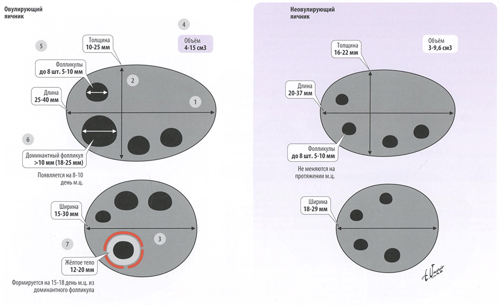 Яичники. Протокол нормы в УЗИ