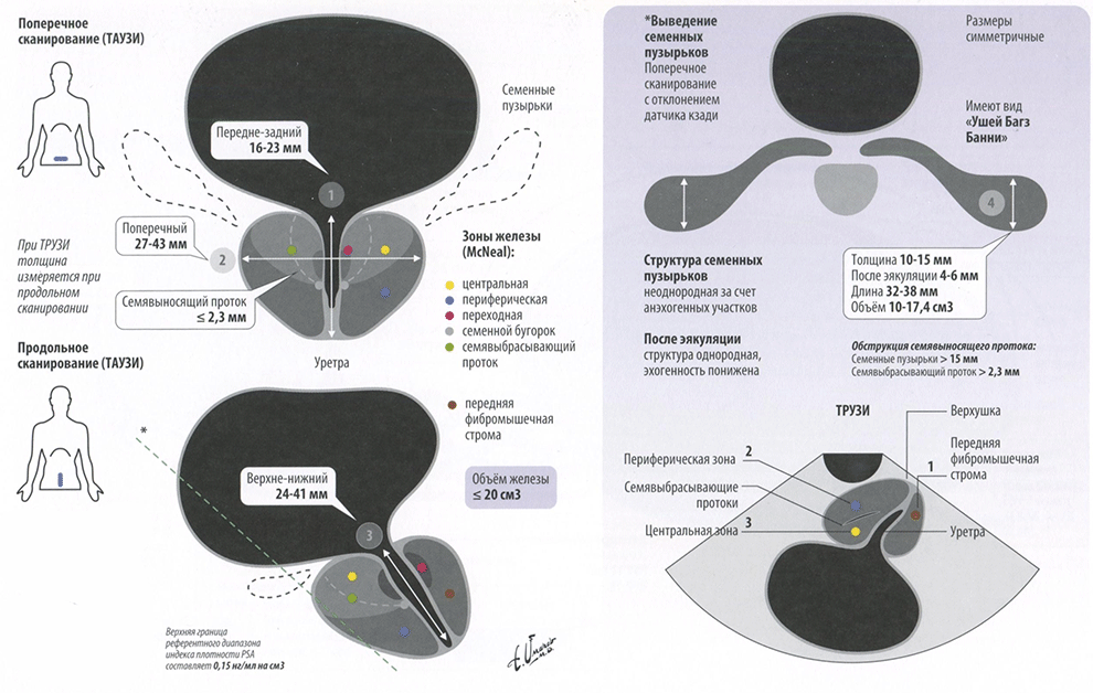 Простата и семенные пузырьки. Протокол нормы в УЗИ