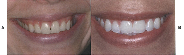  Анализ улыбки является важной частью обследования