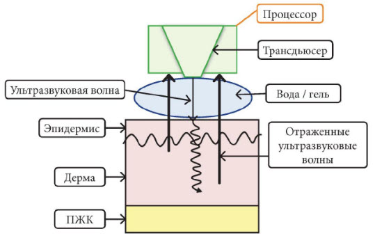 Рис. 1. Принцип получения изображения при ультразвуковом сканировании кожи