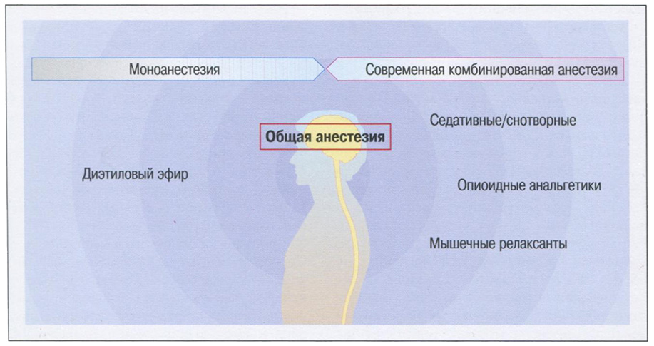 Рис. 1.6 Компоненты и клиническое значение анестезии.