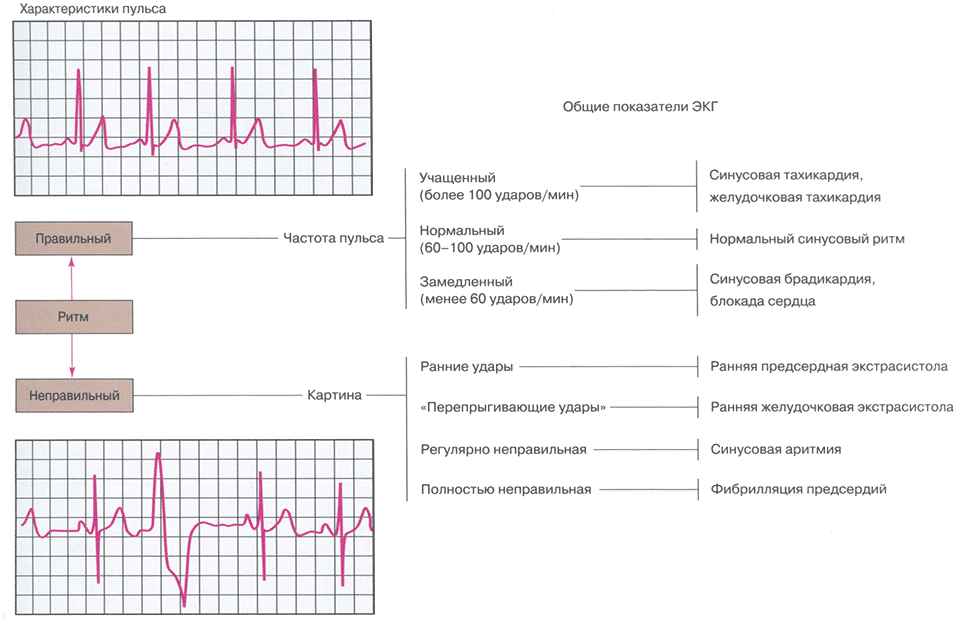 Электрокардиограмма (ЭКГ)