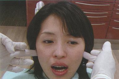 Пальпация задних аспектов височно-нижнечелюстных суставов