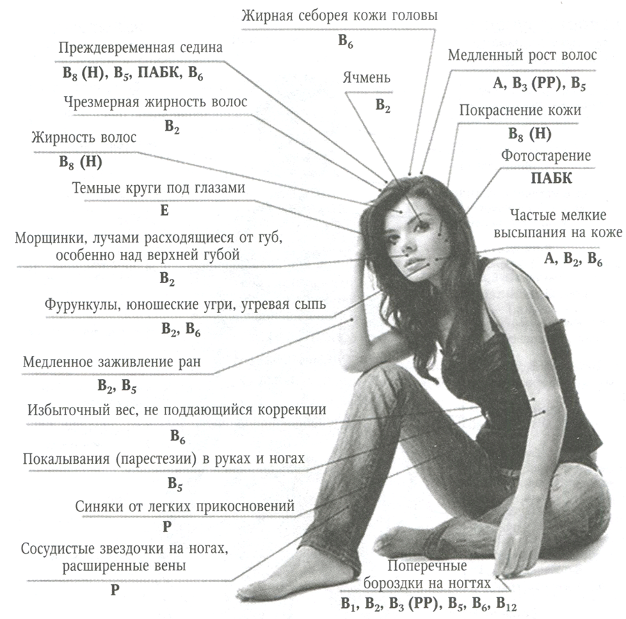 Патологические состояния, обусловленные дефицитом витаминов Патологические состояния, обусловленные дефицитом витаминов