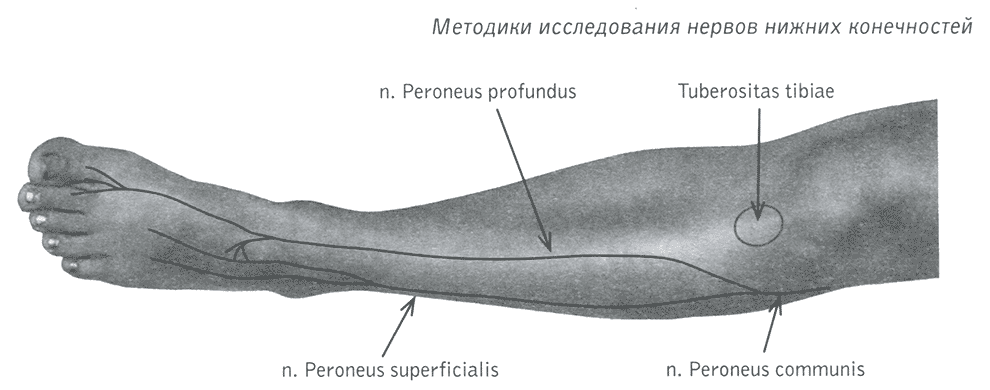 Рис. 124. Схема поверхностного и глубокого малоберцовых нервов