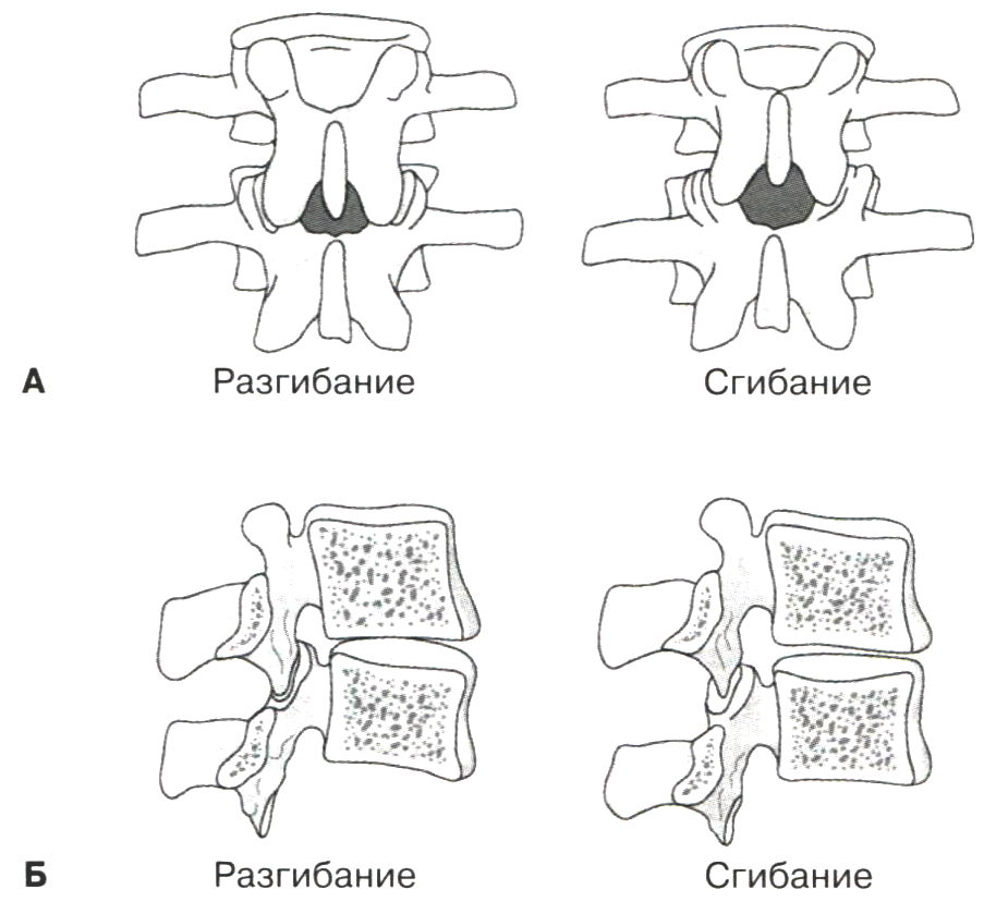  Влияние сгибания на соседние позвонки. А. Вид сзади. Б. Вид сбоку. Межпозвоночное отверстие при сгибании увеличивается