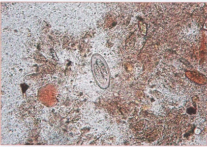 Яйцо острицы продолговатой в кале - несколько асиллметричной формы Яйцо острицы продолговатой в кале - несколько асиллметричной формы