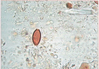 Яйца власоглава имеют удлиненную форму, напоминают лимон или бочонок со светлыми "про-бочками" на полюсах Яйца власоглава имеют удлиненную форму, напоминают лимон или бочонок со светлыми "про-бочками" на полюсах