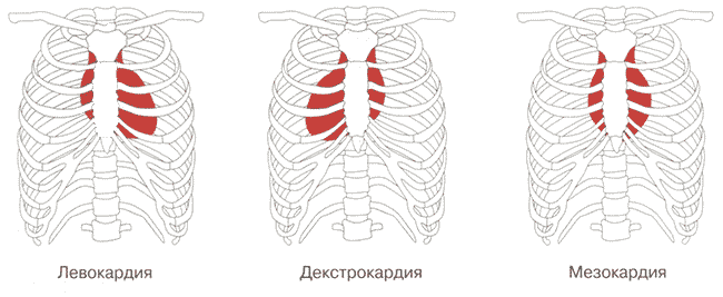 Рис. 2.1. Схема вариантов положения сердца в грудной клетке (по Lai W.W., 2010). Рис. 2.1. Схема вариантов положения сердца в грудной клетке (по Lai W.W., 2010).