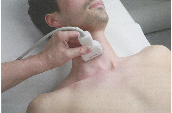 Центр рабочей поверхности датчика устанавливают над сонным бугорком