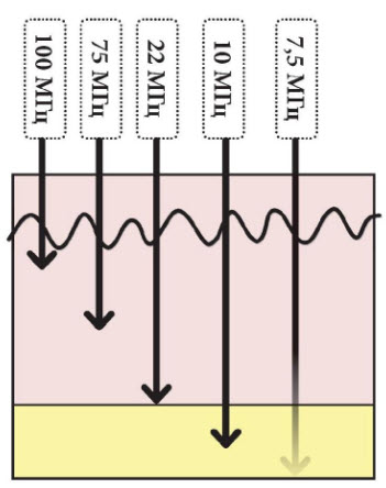 Рис. 2. Схематичное изображение взаимосвязи частоты ультразвуковой волны и глубины ее проникновения в кожу