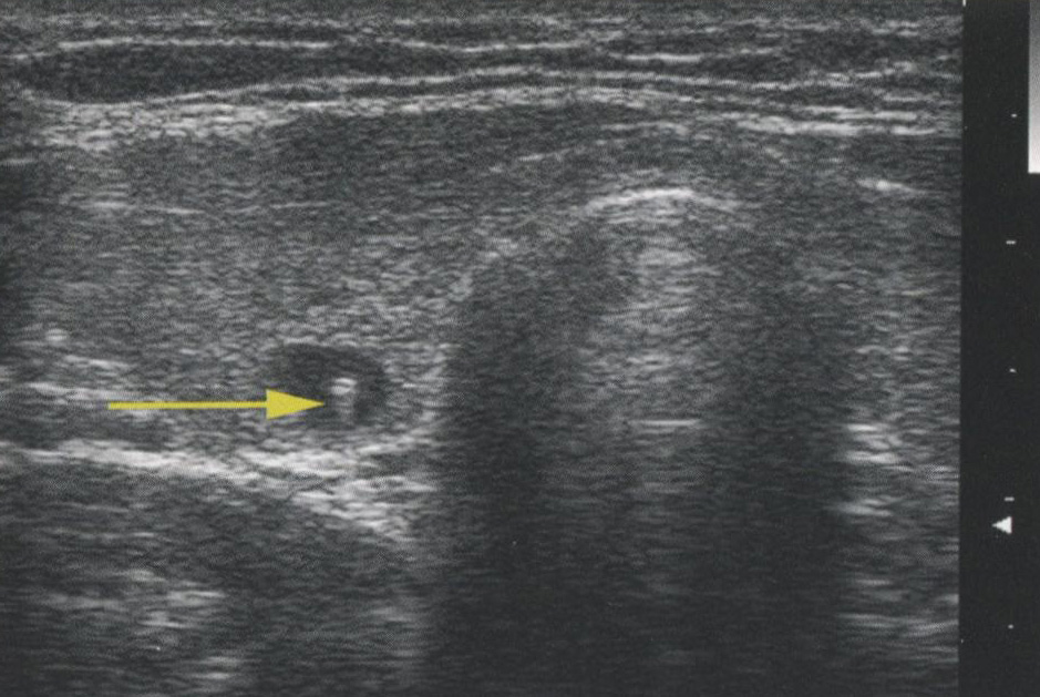 Артефакт «кошачий глаз». Артефакт «хвост кометы» также называется артефактом Артефакт «кошачий глаз». Артефакт «хвост кометы» также называется артефактом