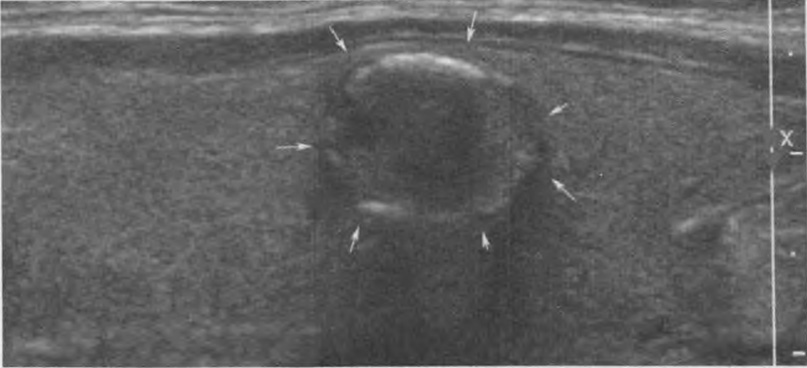 Пример изображения узла ЩЖ